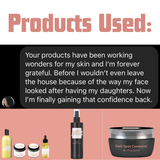 Bye-Bye Acne